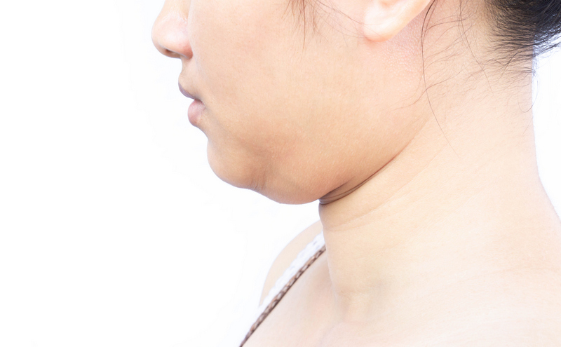femme au double menton
